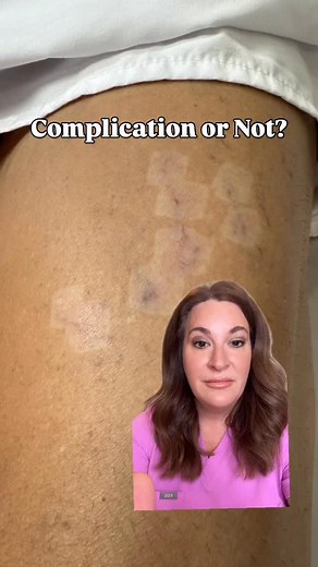 Knowing which modality to use when addressing patient concern’s is critical! You have to consider both what the laser is capable of and the skin condition of your patient. Remember, it’s okay to say no if you don’t have the proper tools 💖 | EnlightenU Advanced Laser Training