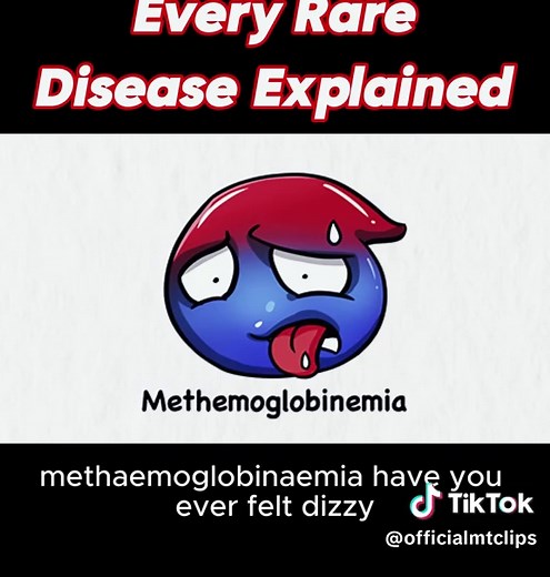 Understanding Rare Diseases: A Comprehensive Guide