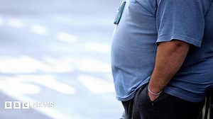 Obese people in Wales 'denied' life saving treatment
