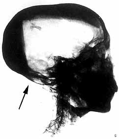 Determining The Cause Of Death