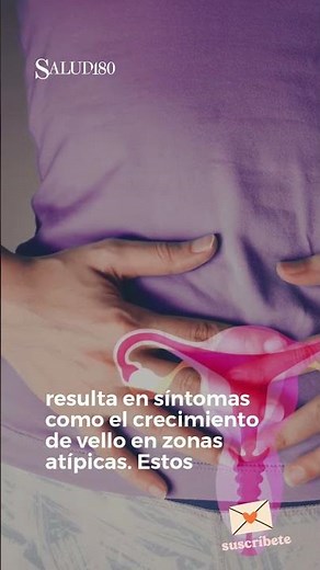 Síndrome de ovario poliquístico #enfermedad #sintomas #SOP #mujer #salud180