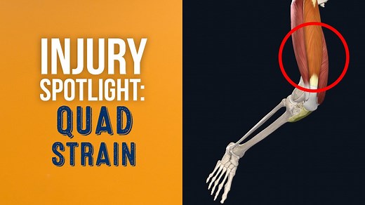 Join Airrosti's Dr. Ally Jackson as she presents the common causes and signs of a quad strain. She also examines different treatment methods to help you get you back on your feet. *Special thanks to 3D4Medical.com #CompleteAnatomy | Airrosti