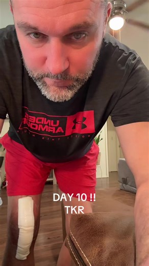 Total Knee Replacement Recovery: Day 10 Insights