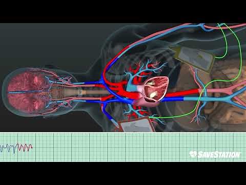 SPANISH: DEA in Action | A 3D Look Inside the Body