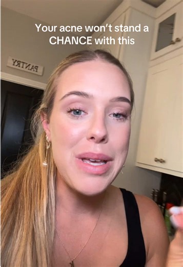 Effective Solutions for Treating Bad Acne