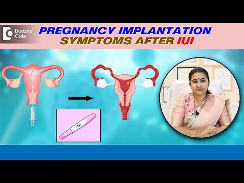 4 Signs of IMPLANTATION after IUI | Pregnancy Implantation Symptoms -Dr.Sneha Shetty|Doctors' Circle