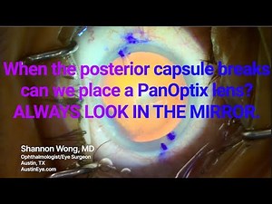 When the posterior capsule breaks can we place a panoptix lens? ALWAYS LOOK IN THE MIRROR.