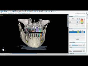 Master Jaw & Teeth Segmentation in Blue Sky Bio + FREE 3D Models! | Blue Sky Bio