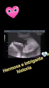 93 reactions · 43 shares | Sabes que PIERDES más...❤️ "Eco 2D + Consulta de Ginecóloga"...  De $800 pesos, solo pagas $399 pesos.  Válido solo del 7 al 15 de Agosto del 2024... ⏱️ Limitado a Agenda...⏱️ Manda un mensaje ya... #eco4d #ecodeembarazo #ginecologa #bebes #mujeres #mamá #maternidad #salud #partonatural #parto #cesarea #embarazo #ginecologo #bebe American Lab CmasSalud Tomas Tijerina C + Dental | DepoDental Plus | Facebook