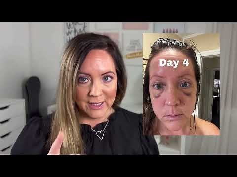 Why do PRF vs PRP? |Is it worth it at all?