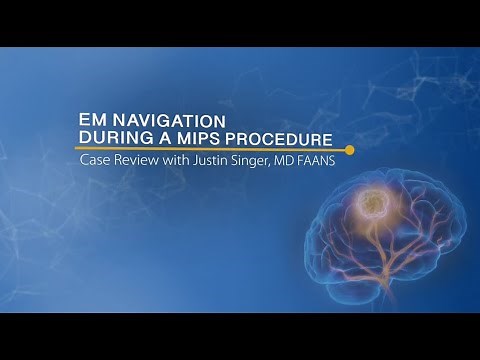 NICO BrainPath Navigation Probe Adapter, Justin Singer MD