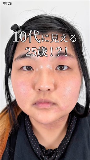 [Double eyelid surgery] A 25-year-old who looks like a teenager!? #shorts