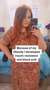 Incredible Weight Loss Transformations | Weightloss check ❤️ #weightlossjourney #weightloss #fitness #fitnessmotivation #Weightlosstransformation #healthylifestyle #workout #motivation #fit #health #fitfam #healthy #gym #fitnessjourney #weightlossmotivation #transformation #fitspo #goals #bodybuilding #keto #healthyfood #exercise #diet #nutrition #gymlife #fitlife #healthyeating #ketodiet #cardio #fatloss | Easy Weightloss
