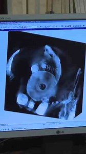 The Antikythera Mechanism Mystery