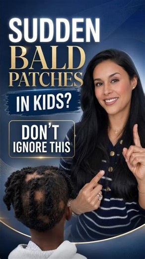 Sudden bald patches in kids? Don’t ignore this