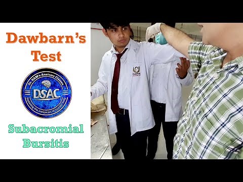 Dawbarn's Test | Subacromial Bursitis | Dawbarn Sign | Dr. SAM | #dsac