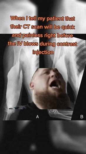 Patient CT Scan Experience: IV Blow During Contrast Injection