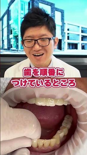 [Implants] The doctor explains the large number of implant treatments!