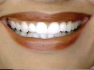 Crest Whitestrips - 2002 Commercial