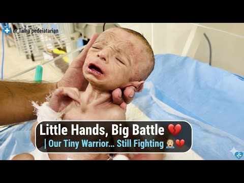 Fragile baby Muqadas Hope , Feeding Progress, Weight Gain & Healing | Dr Talha NICU