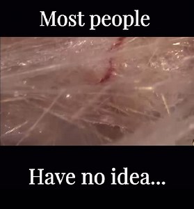 Fascia is quite possibly the most impactful tissue in the human body-and we’re nowhere near understanding its full potential. If fascia dries out—it loses one of its most fundamental properties. It stops orchestrating what it was designed for. And since 99.9% of your body is located within the fascia, blocked/dysfunctional fascia results in a dysfunctional body. #fasciamedicine #drjes #fasciahealing #fascia | The Fascia Movement