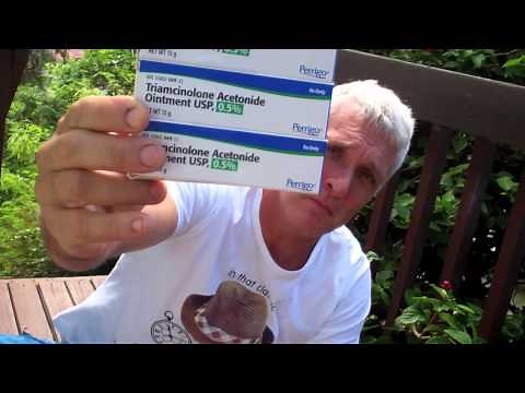 The Only Medicine that Cured my Eczema! Triamcinolone Acetonide cream usp 0.1