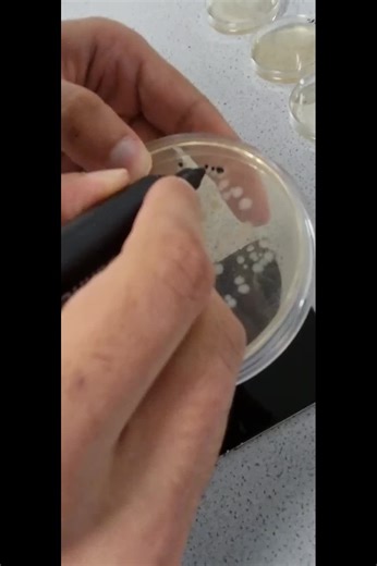 Cómo calcular CFU por ml en un ensayo de viabilidad