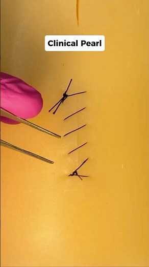 How to Remove a Running Suture ✅ #medicaleducation #clinicalskills #stitches #shorts