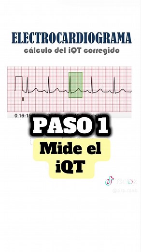Cómo calcular el QT corregido (QTc) en EKG