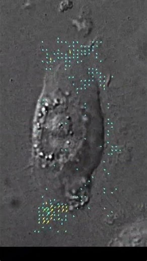 this is how skin cell move to the wound site #biomedical #science