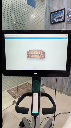 Every patient who visits us receives a 3D intraoral scan using the world’s best iTero scanner @ SVDC