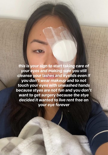 Chalazion Removal Surgery Explained: My Experience