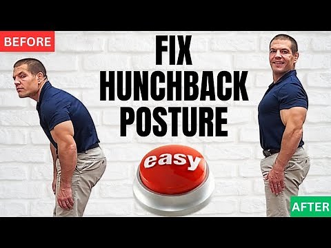 How To Fix Hunchback Posture (the EASY way)