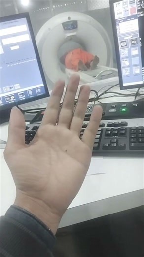 #hospital #learningradiology #ctreport #angiography #ctscan #medicalimaging #arterialphase