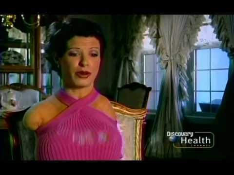 armlessClassics - Barbara Guerra in Discovery Health