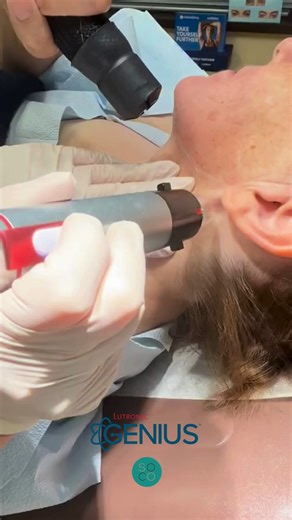✨ Tighten, Tone & Transform with Genius RF Microneedling ✨ Dr. Evans...