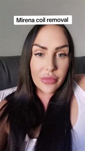 Mirena Coil Removal Journey - My Experience and Side Effects