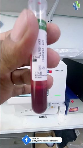 “Full Blood Count (FBC) Test on Mindray BC-10 Hematology Analyzer | Lab Technology Explained