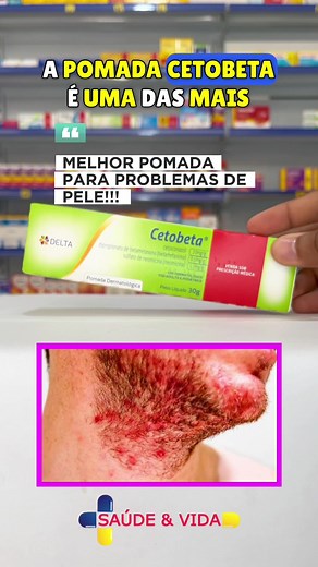 Benefícios da Pomada Cetobeta para Problemas de Pele
