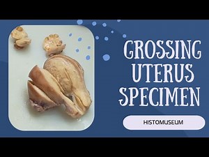 Uterine pathology| Real lab grossing process| #histopathology #uterinebleeding #uterusremoval #lab