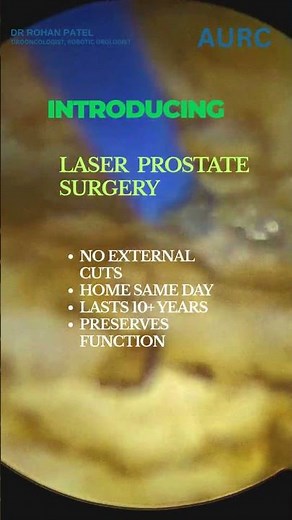 How is Prostate Laser Surgery done ? | HoLEP Before and After | Dr. Rohan Patel