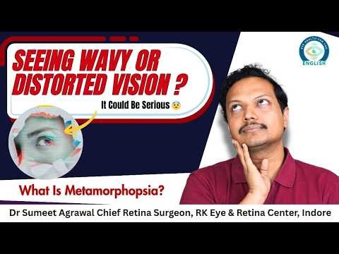 What Is Metamorphopsia? Wavy Vision Causes, Symptoms & Treatment ⚠️ | Dr. Sumeet Agrawal