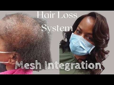 Mesh Integration Hair Loss System: No braided weave | No wig | Minimal tension