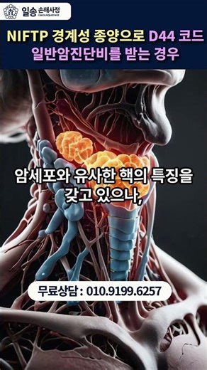 D44 NIFTP 일반암진잔비 #D44일반암진단비 #NIFTP암진단비 #d44 #NIFTP #알진단비
