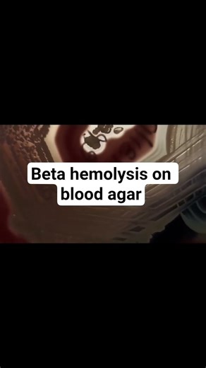 beta hemolysis on blood agar |Staphylococcus aureus