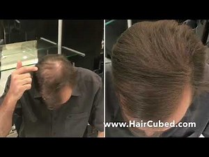 Caboki Hair Fiber vs Hair3- Amazing Video Thinning Hair in the front and back !