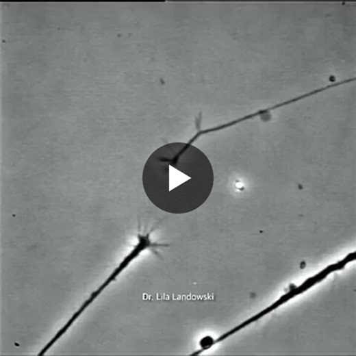 You are looking at two neurons under a microscope, filmed in real time. At first, they are separate. Then, slowly, you see them reaching toward each other. Axons and dendrites extending… | Sue Langley | 131 comments