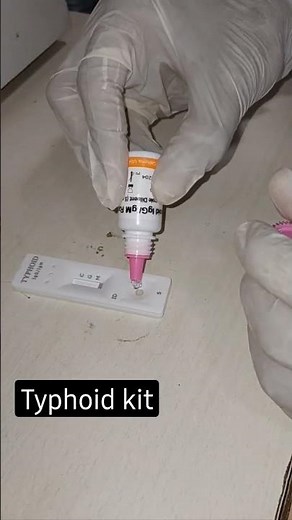 Typhi dot [IgG & IgM] test procedure 🦠🦠