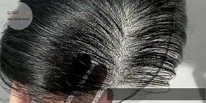 71K views · 1.9K reactions | We are a wholesale hair system manufacturer and supplier based in China. Since we manufacture and distribute men's hair replacement systems in bulk ourselves, we are able to keep our prices low and our quality high.欄 #wigs #toupee #hair_system | Bono Hair-Hair Replacement Factory | Facebook