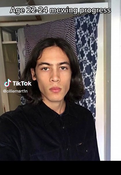 Adult Mewing Transformation: Jawline Evolution at Age 22-24